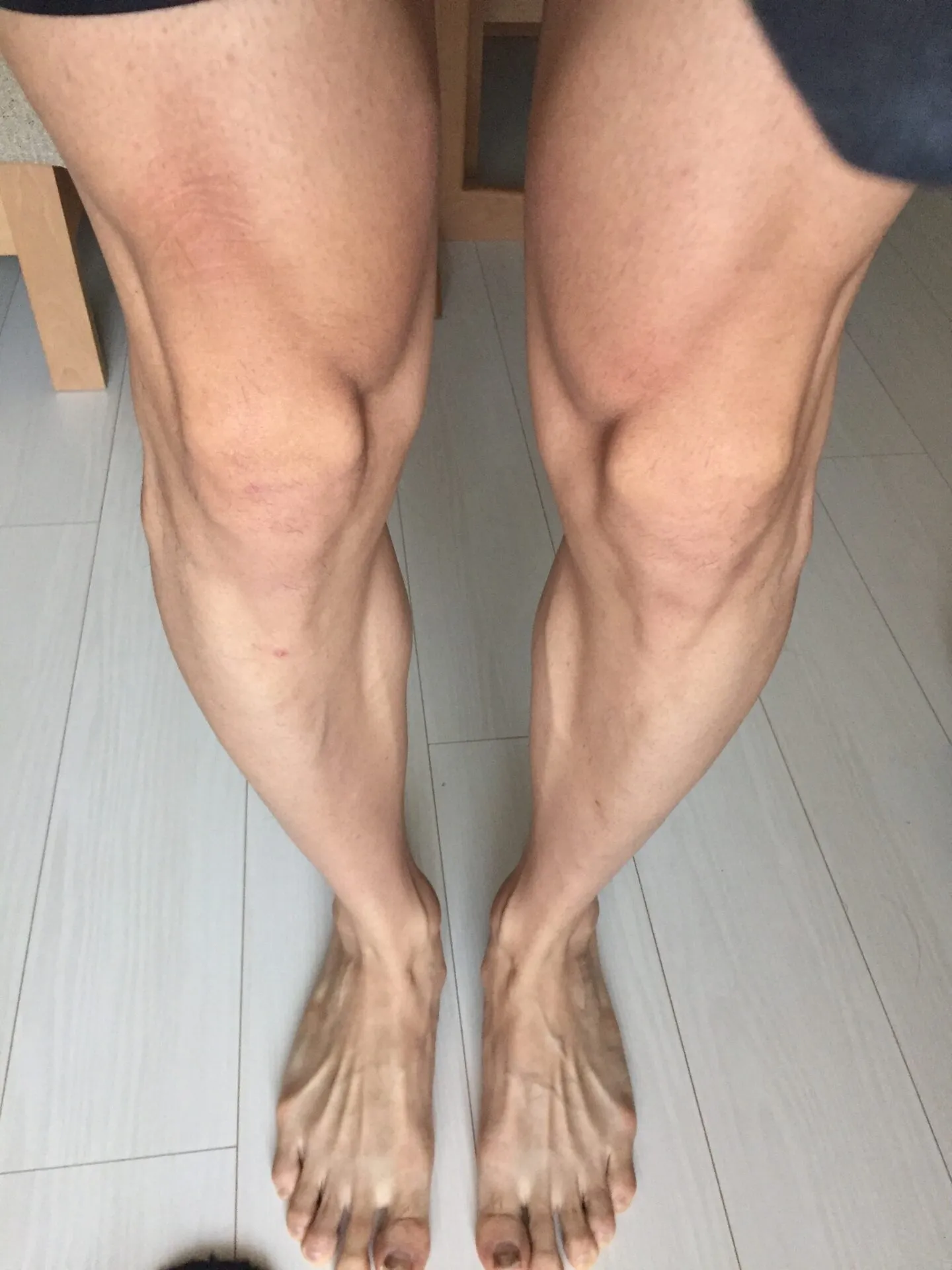 legs