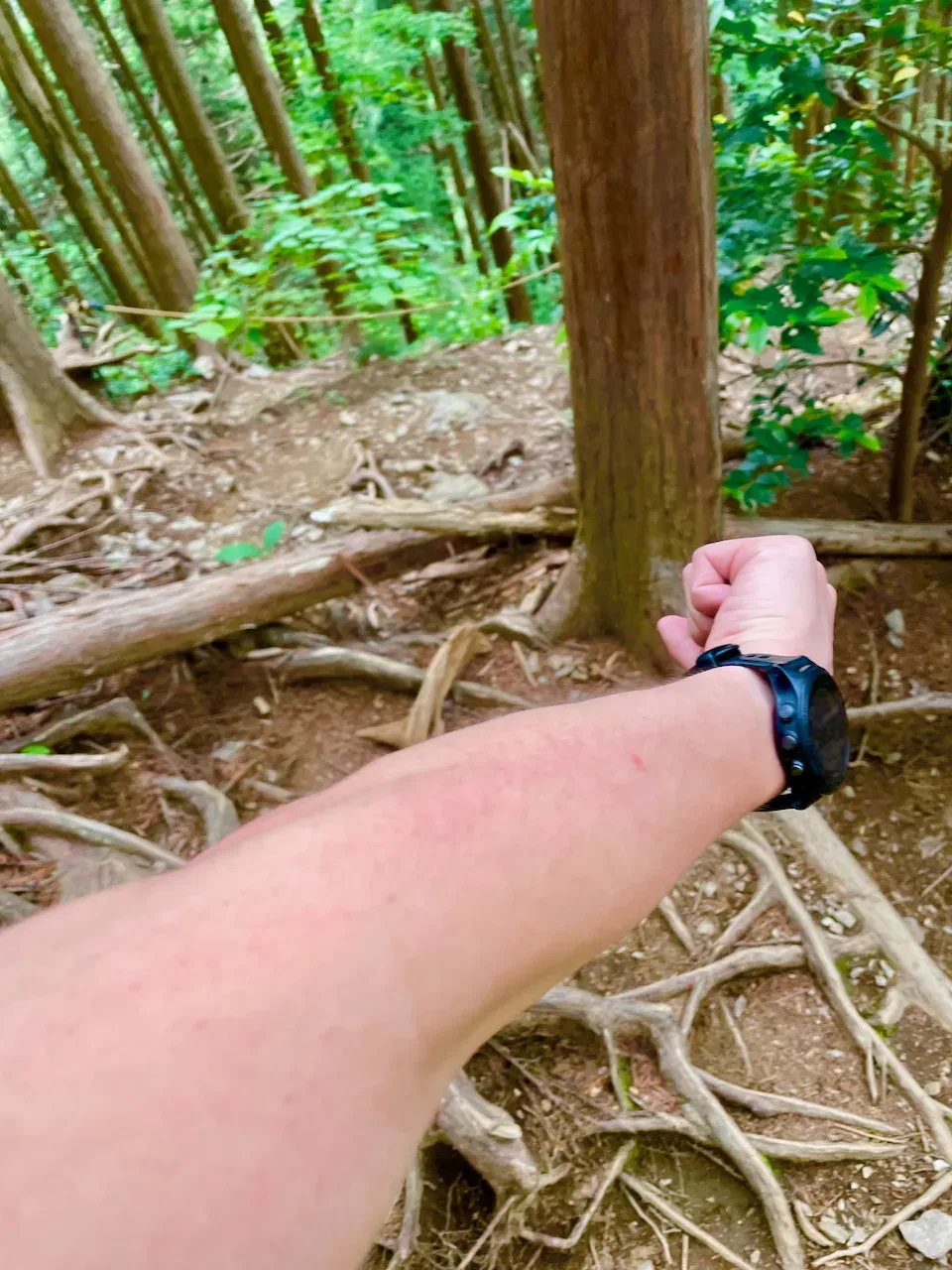 ちょっと鮮やかさをプラスした写真。両腕が赤いのです。時間が経ったから少し引いてきたけど。