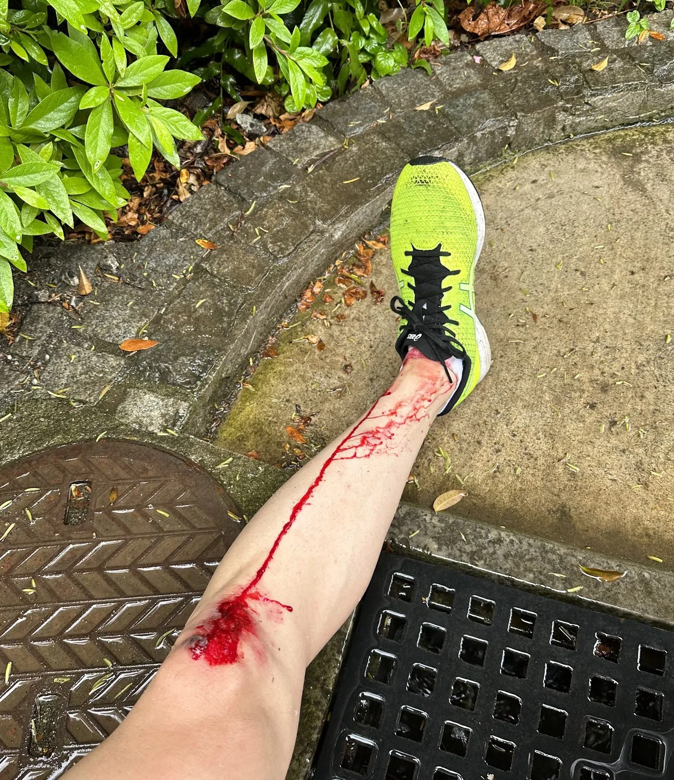 擦り傷に”エアウォール”が良い!キズパワーパッドの1/7ぐらいのコスト - 画像4