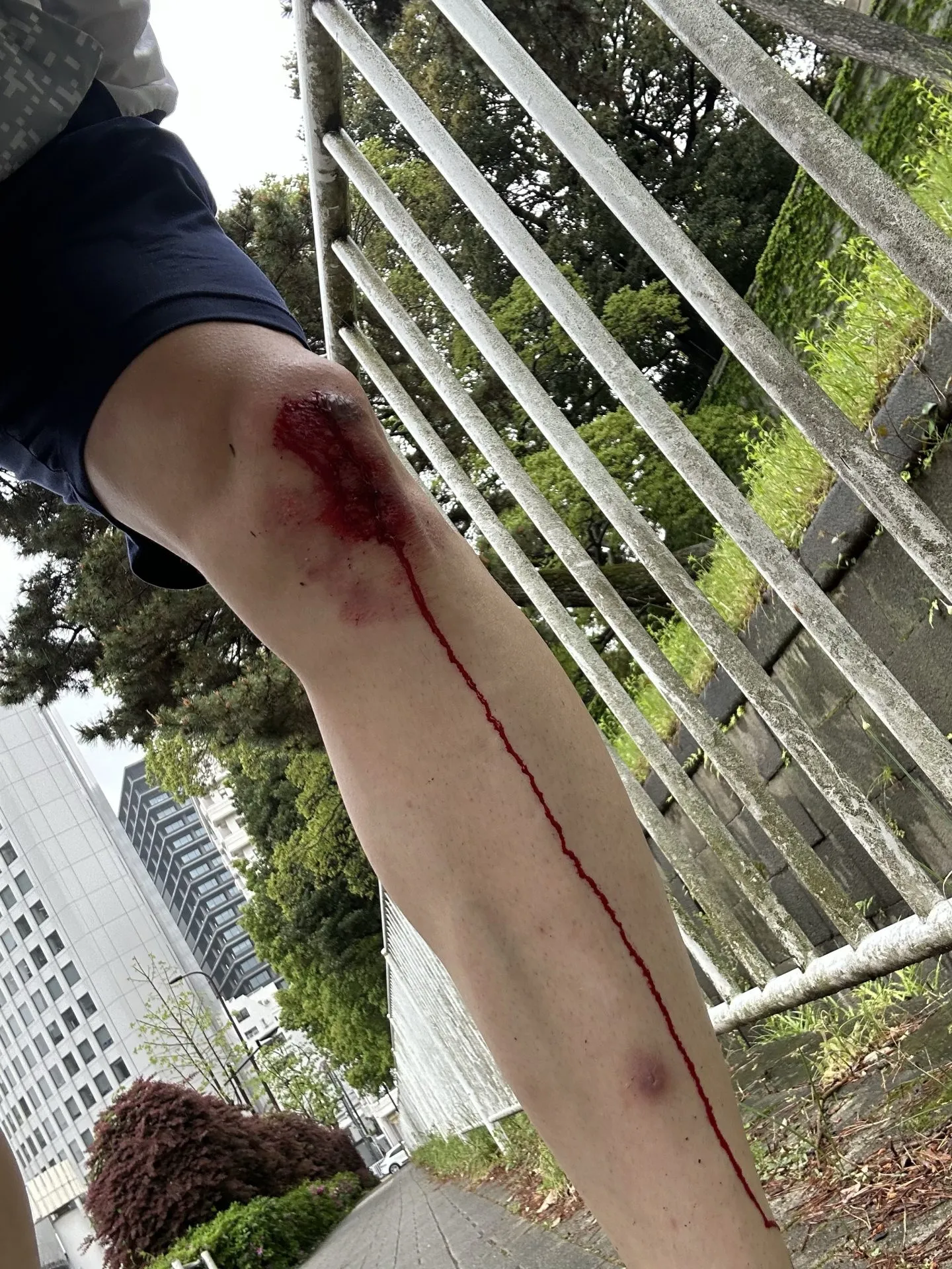 擦り傷に”エアウォール”が良い!キズパワーパッドの1/7ぐらいのコスト - 画像3