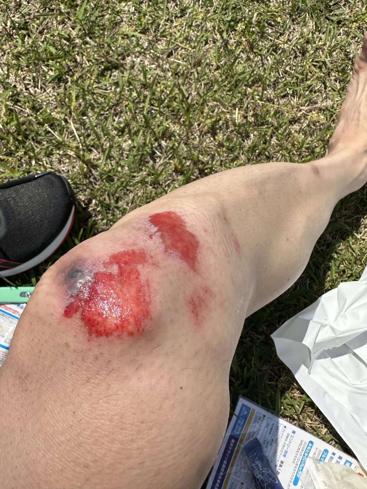 擦り傷に”エアウォール”が良い!キズパワーパッドの1/7ぐらいのコスト - 画像6